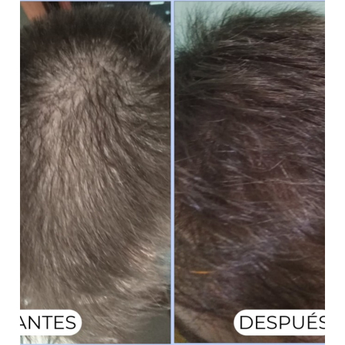 Alma Secret - Champô purificante Shikakai para cabelos normais ou oleosos