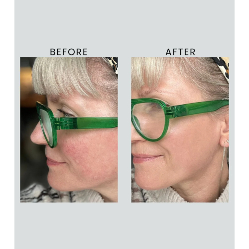 Altruist - Creme de Dia Dermatologist Anti-Redness & Pigmentation Light SPF50