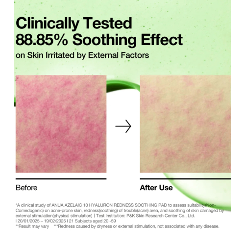 Anua - Discos Azelaic 10 Hyaluron Redness Soothing formato de discos