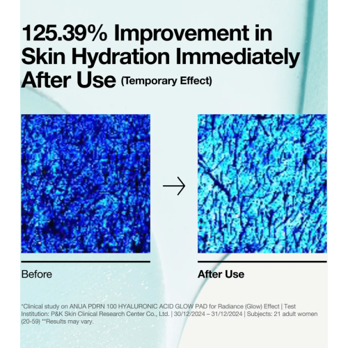 Anua - Formato de almofadas PDRN 100 Hyaluronic Acid Glow