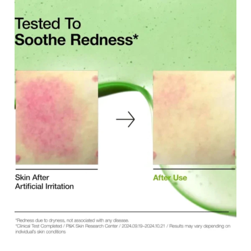 Anua - Sérum antiacne com 10+ ácido azelaico e ácido hialurônico