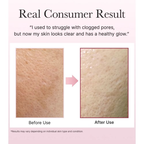 Arencia - Sabonete Facial Fresh Rosehip Mochi