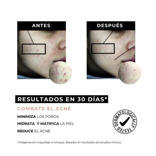 Arganour - Creme antiacne redutor de marcas  Equilibrium - Pele oleosa e com tendência acneica