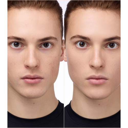 Catrice - Instant Bright Corretivo - 032N