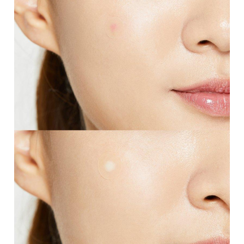 COSRX - Manchas de manchas Acne Pimple Master Patch