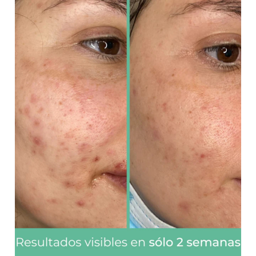 CR Cosmetics - *Purifying* - Creme facial regulador de sebo