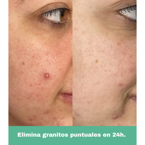 CR Cosmetics - *Purifying* - Roll-on anti-manchas