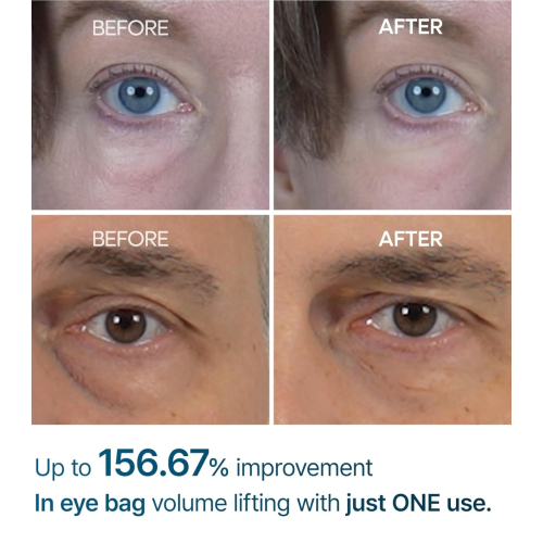 Dr.Melaxin - Creme para Olheiras Eyephalt