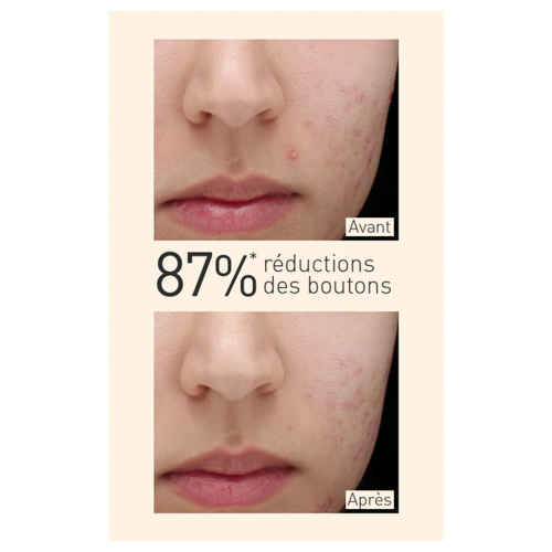 Embryolisse - Sérum matificante para pele mista a oleosa com extrato de cúrcuma