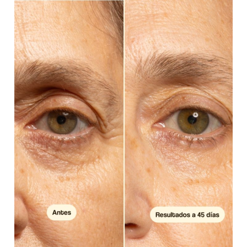 Freshly Cosmetics - Contorno de Olhos Antirrugas Exosome Well-Ageing