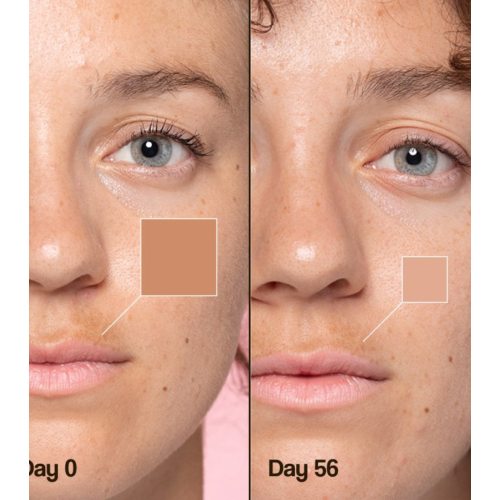 Freshly Cosmetics - Creme facial despigmentante Lotus Radiance Dark Spot Treatment