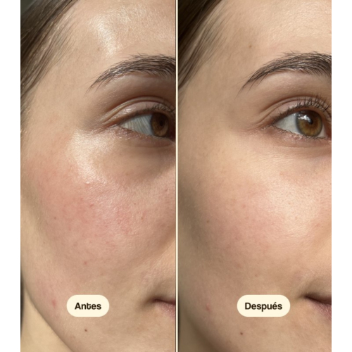 Freshly Cosmetics - Creme Hidratante Diurno Centella Asiatica CICA Calm - Pele seca e sensível