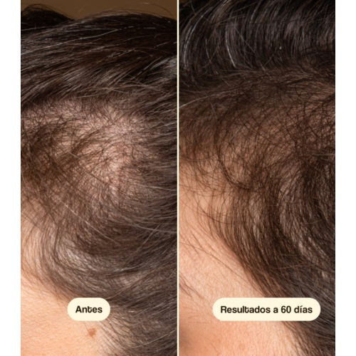 Freshly Cosmetics - Tratamento anti-queda de cabelo Hair Growth & Density