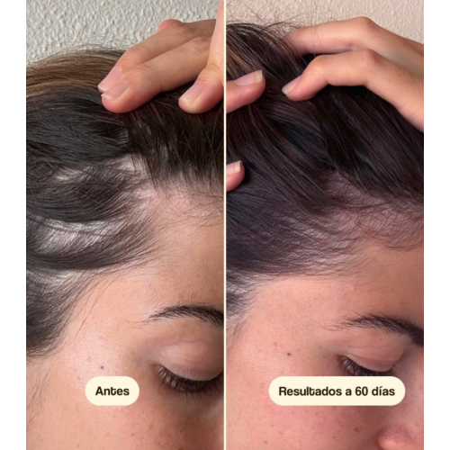 Freshly Cosmetics - Tratamento anti-queda de cabelo Hair Growth & Density