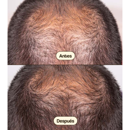 Freshly Cosmetics - Tratamento anti-queda de cabelo Hair Growth & Density