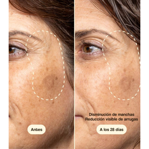 Freshly Cosmetics - Tratamento Facial com Vitamina C