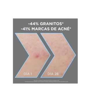 Garnier - *Skin Active* - Soro anti-manchas com Niacinamida, AHA, BHA e Carvão