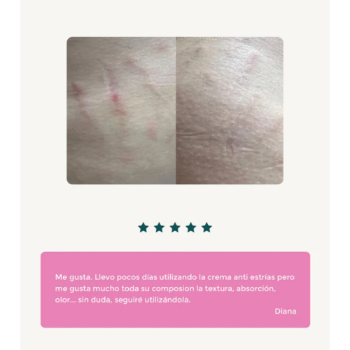 Green Cornerss - Creme anti-estrias com Sangue de Dragão