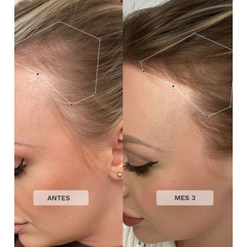 Hairburst - Vitaminas para o cabelo Advance + Premium