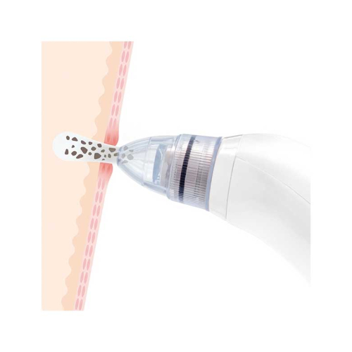 InnovaGoods - limpador facial elétrico para cravos Pore·Off