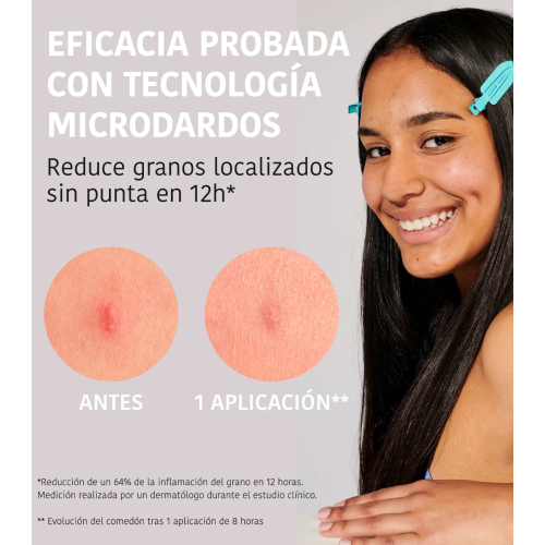 Iroha Nature - *Acne Prone Skin* - Adesivos de ácido salicílico para espinhas Microdarts