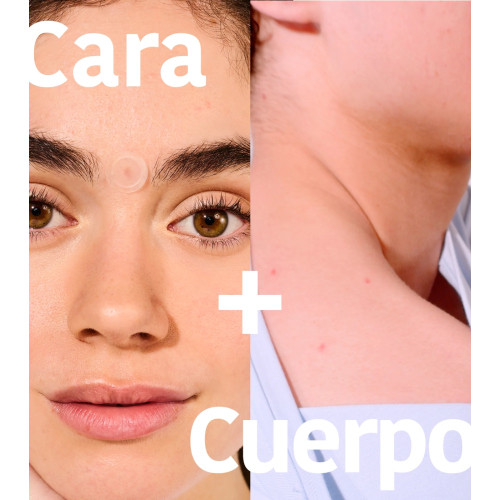 Iroha Nature - *Acne Prone Skin* - Adesivos de ácido salicílico para espinhas Microdarts