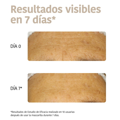 Iroha Nature - Máscara Antirrugas e Antienvelhecimento para Rosto e Pescoço - Colágeno + Ácido Hialurônico