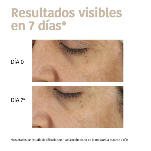 Iroha Nature - Máscara facial de ácido tranexâmico Dark Spots