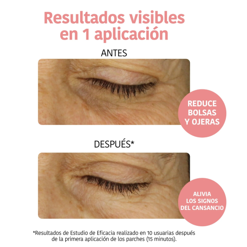 Iroha Nature - Patches anti-fadiga e clareadores - Vitamina c, pepino e ácido hialurônico