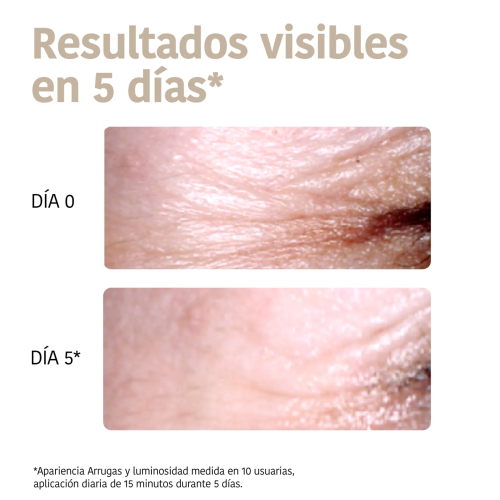 Iroha Nature - Remendos antirrugas, anti-inchaço e clareadores Global Eye Care - Niacinamida, Cafeína e Peptídeos