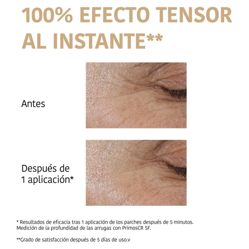 Iroha Nature - Adesivos para Contorno dos Olhos 99% Collagen Lifting Effect - 6 units