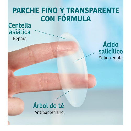 Iroha Nature  - *Acne Prone Skin* - Adesivos para espinhas com ácido salicílico XL