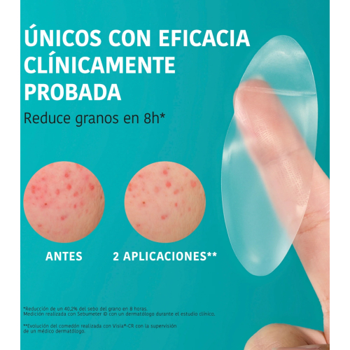 Iroha Nature  - *Acne Prone Skin* - Adesivos para espinhas com ácido salicílico XL