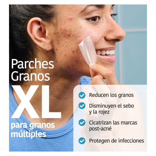 Iroha Nature  - *Acne Prone Skin* - Adesivos para espinhas com ácido salicílico XL