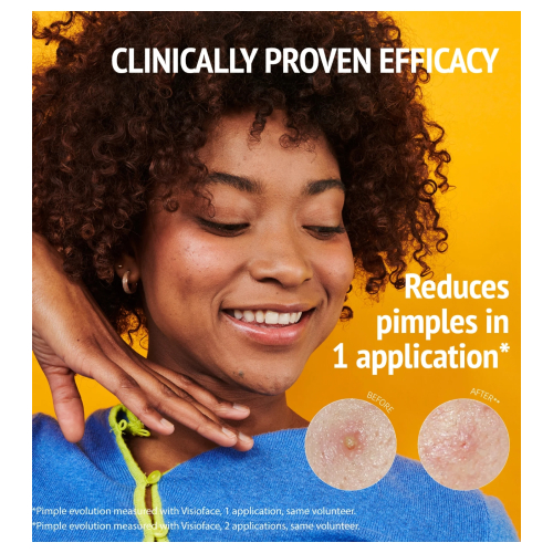 Iroha Nature - *Pride* - Adesivos SOS para Acne com Ácido Salicílico