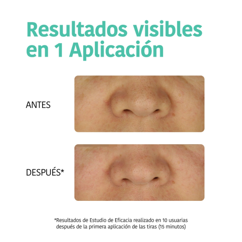 Iroha Nature - Detox Strips Anti Black Dots - Carbono