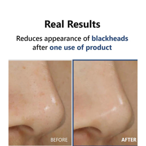 ISNtree - *Mugwort* - Tone Evening Serum Hyper Acid 4 AHA BHA PHA LHA 30