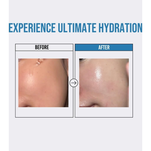 Jumiso - *Waterfull* - Sérum facial hidratante Hyaluronic Acid