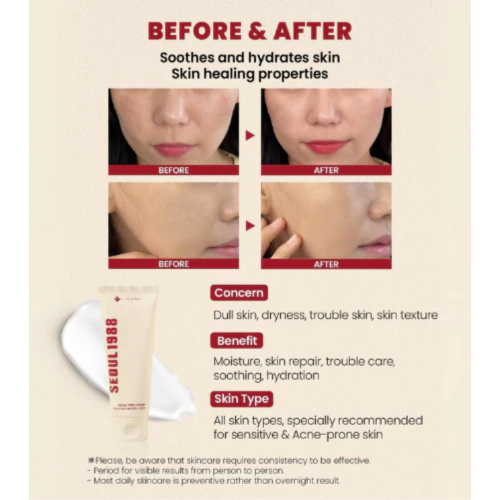 K-Secret - *Seoul 1988* - Creme Facial Snail Mucin 93% + Rice