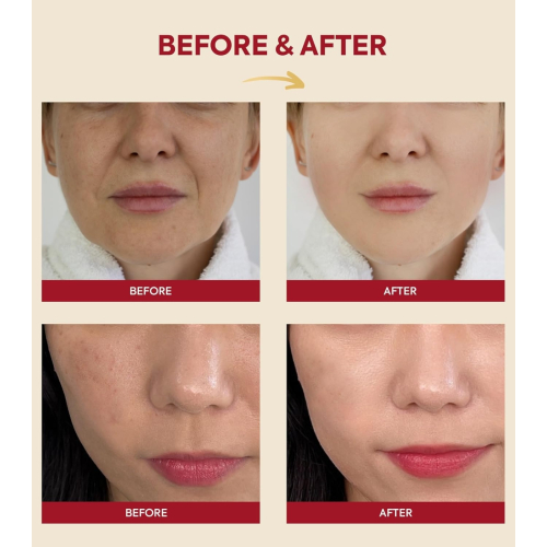 K-Secret - *Seoul 1988* - Essência Snail Mucin 97% + Rice