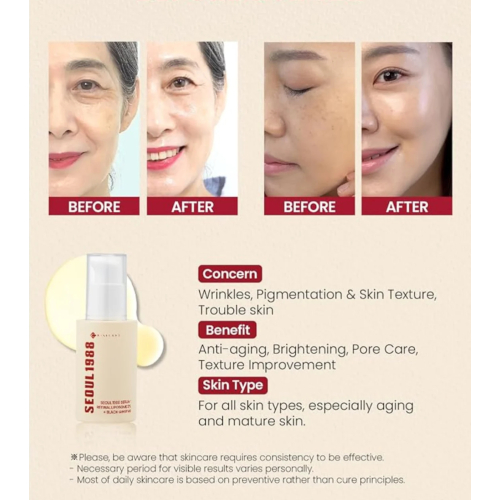 K-Secret - *Seoul 1988* - Soro Retinal Liposome 2% + Black Ginseng