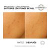 Loreal Paris - *Bright Reveal* - Peeling esfoliante antimanchas de ação rápida - Marcas pós-acne e manchas escuras