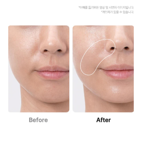 Medicube - *Age-R* - Dispositivo avançado de cuidados faciais Booster Pro Ex