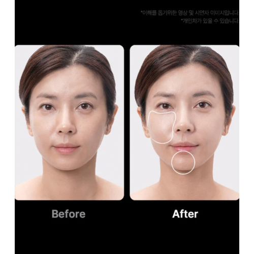 Medicube - *Age-R* - Dispositivo avançado de cuidados faciais Booster Pro Ex