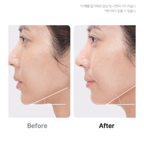 Medicube - *Age-R* - Dispositivo avançado de cuidados faciais Booster Pro Ex