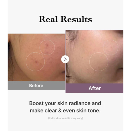 Medicube - *Age-R* - Tônico Hidratante Glutathione Glow Toner