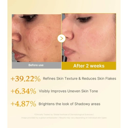 Medicube - *Kojic Acid* - Tónico facial exfoliante