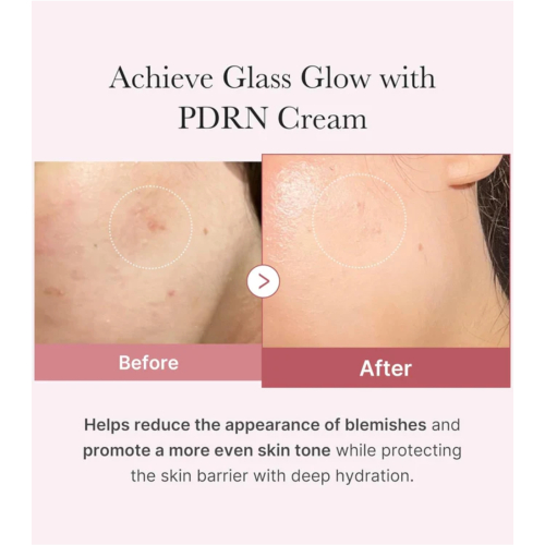 Medicube - *PDRN Pink* - Creme facial hidratante Hyaluronic Moisturizing