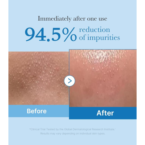 Medicube - *Zero Pore* - Óleo de Limpeza Blackhead Deep