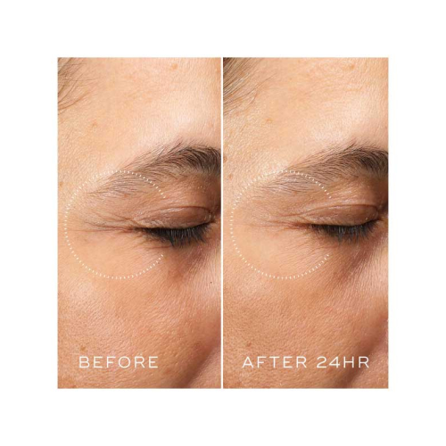 Medik8 - *Crystal Retinal* - Creme de contorno de olhos antienvelhecimento com Retinal e Vitamina A Ceramide Eye 6